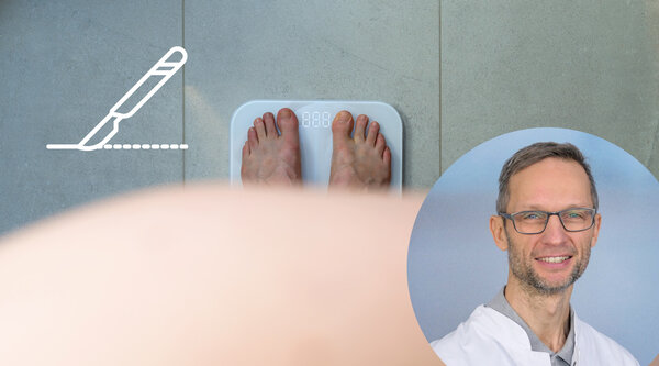 Dr. Michael Dykta informiert zum Thema Adipositas | © Kliniken Ostallgäu-Kaufbeuren