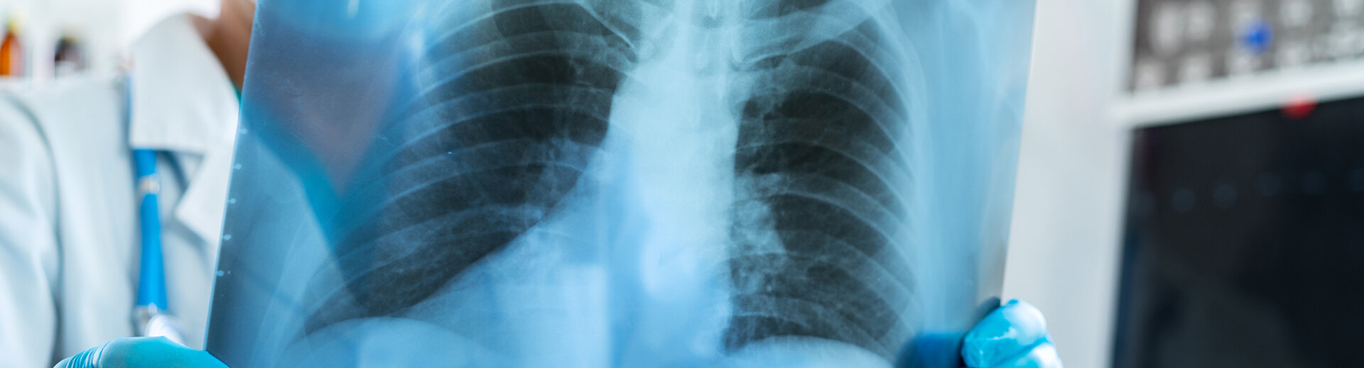 Untersuchung der Lunge – moderne Diagnostik und Therapie
